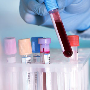 Cancer growth explorer : Scientists look for signs to how illness ‘is conceived’